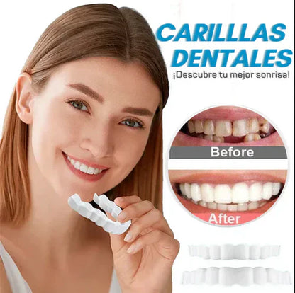 CARILLAS SNAP-ON SMILE SONRISA PERFECTA AL INSTANTE